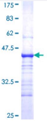 SDS-PAGE (C4B-0051H).jpg